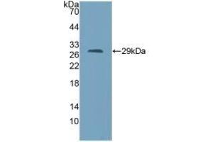 Detection of Recombinant AGA, Mouse using Polyclonal Antibody to Aspartylglucosaminidase (AGA) (AGA 抗体  (AA 24-260))