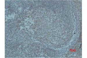 Immunohistochemistry (IHC) analysis of paraffin-embedded Human Tonsil Tissue using HIF-1beta Polyclonal Antibody. (ARNT 抗体)
