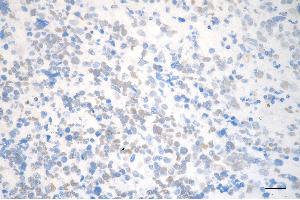 anti-C-terminal Binding Protein 2 (CTBP2) antibody