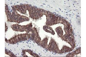 Image no. 12 for anti-Diphthamide Biosynthesis Protein 2 (DPH2) antibody (ABIN1497892)