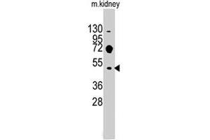Western blot analysis of Evx2 polyclonal antibody  in mouse kidney tissue lysates (35 ug/lane). (EVX2 抗体  (C-Term))
