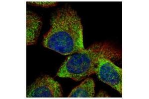 ICC/IF Image Confocal immunofluorescence analysis (Olympus FV10i) of methanol-fixed A431, using VTA1, antibody (Green) at 1:500 dilution. (VTA1 抗体  (Center))