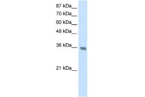 WB Suggested Anti-HNRPA1 Antibody Titration:  1. (HNRNPA1 抗体  (C-Term))