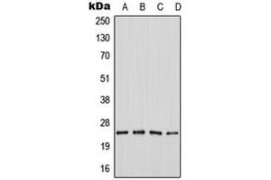 Western blot analysis of SEI-1 expression in MOLT4 (A), Jurkat (B), SP2/0 (C), PC12 (D) whole cell lysates.
