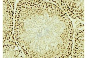 ABIN6276700 at 1/100 staining Mouse testis tissue by IHC-P. (HDAC9 抗体  (C-Term))