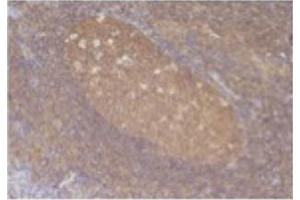 Image no. 1 for anti-Chemokine (C-C Motif) Ligand 5 (CCL5) antibody (ABIN465158) (CCL5 抗体)