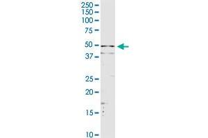 Western Blotting (WB) image for anti-serpin Peptidase Inhibitor, Clade A (Alpha-1 Antiproteinase, Antitrypsin), Member 3 (SERPINA3) (AA 1-423) antibody (ABIN513025)