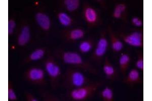 Immunofluorescence staining of methanol-fixed HeLa cells using MEF2A (phospho-Thr312) antibody (E011039, Red) (MEF2A 抗体  (pThr312))