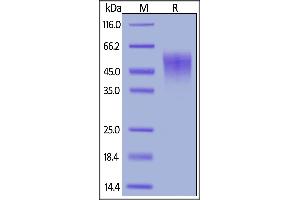 Mouse IL-2 R alpha, His Tag on  under reducing (R) condition. (CD25 Protein (AA 22-236) (His tag))