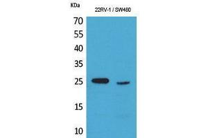 Western Blotting (WB) image for anti-Synovial Sarcoma, X Breakpoint 2B (SSX2B) (C-Term) antibody (ABIN3187724) (Synovial Sarcoma, X Breakpoint 2B (SSX2B) (C-Term) 抗体)