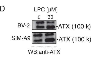 Western Blotting (WB) image for anti-Ectonucleotide Pyrophosphatase/phosphodiesterase 2 (ENPP2) (C-Term) antibody (ABIN2856278)