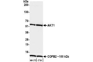Western Blotting (WB) image for anti-V-Akt Murine Thymoma Viral Oncogene Homolog 1 (AKT1) (AA 100-150) antibody (ABIN7795633)