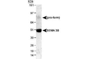 Western blot analysis of SEMA3B in mouse E16 cerebellum lysate with SEMA3B polyclonal antibody . (SEMA3B 抗体  (AA 100-200))