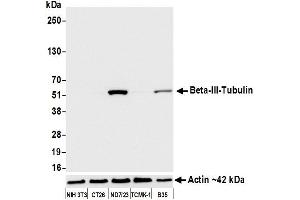 Western Blotting (WB) image for anti-Tubulin, beta 3 (TUBB3) (AA 400-450) antibody (ABIN7453957) (Recombinant TUBB3 抗体  (AA 400-450))