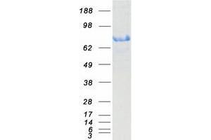 Validation with Western Blot