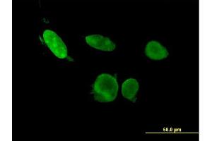 Immunofluorescence of monoclonal antibody to ERF on HeLa cell. (ERF 抗体  (AA 181-290))