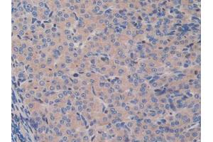 IHC-P analysis of Mouse Ovary Tissue, with DAB staining. (GAB3 抗体  (AA 142-375))