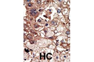 Immunohistochemistry (IHC) image for anti-Epidermal Growth Factor Receptor Pathway Substrate 8 (EPS8) antibody (ABIN3003718) (EPS8 抗体)