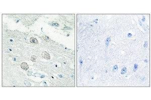 Immunohistochemistry (IHC) image for anti-Janus Kinase 1 (JAK1) (N-Term) antibody (ABIN1849257) (JAK1 抗体  (N-Term))
