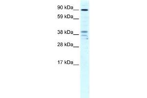 Western Blotting (WB) image for anti-Zinc Finger CCCH-Type Containing 7B (ZC3H7B) (N-Term) antibody (ABIN1109547)