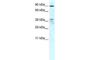 Human Liver; WB Suggested Anti-ZC3H7B Antibody Titration: 4ug/ml. (ZC3H7B 抗体  (N-Term))