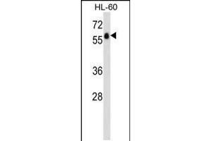 Western blot analysis in HL-60 cell line lysates (35ug/lane). (GPR97 抗体  (N-Term))