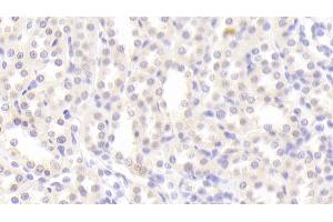 Detection of TJP1 in Rat Kidney Tissue using Polyclonal Antibody to Tight Junction Protein 1 (TJP1) (TJP1 抗体  (AA 23-502))