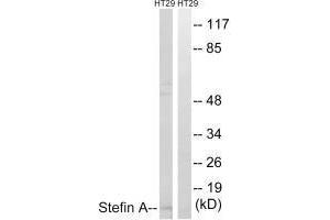 Western blot analysis of extracts from A549 cells, using Stefin A antibody. (CSTA 抗体  (C-Term))