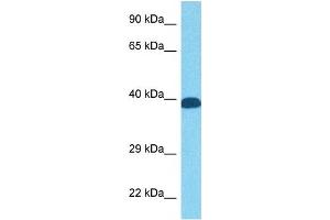 Host:  Rabbit  Target Name:  FOS  Sample Tissue:  Human PANC1 Whole Cell  Antibody Dilution:  1ug/ml (c-FOS 抗体  (N-Term))