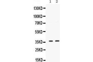 Western blot analysis of SIX1 expression in MCF-7 whole cell lysates (lane 1) and 22RV1 whole cell lysates (lane 2). (SIX Homeobox 1 抗体  (C-Term))