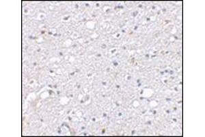 Immunohistochemical staining of human brain tissue using AP30786PU-N at 2. (SIRT2 抗体  (N-Term))