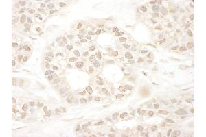 anti-Nuclear Receptor Coactivator 4 (NCOA4) (AA 500-550) antibody