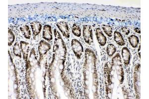 Immunohistochemistry (IHC) image for anti-Musashi Homolog 1 (Drosophila) (MSI1) (AA 21-54), (N-Term) antibody (ABIN5518855)