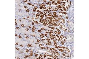 Immunohistochemical staining of human stomach with DHX34 polyclonal antibody , lower shows strong cytoplasmic positivity in parietal cells at 1:50-1:200 dilution.