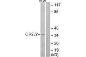 Western blot analysis of extracts from HT-29 cells, using OR2J2 Antibody. (OR2J2 抗体  (AA 263-312))