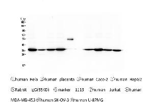 Western blot analysis of Emerin using anti-Emerin antibody . (Emerin 抗体  (N-Term))