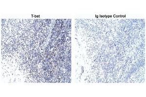 Immunohistochemistry (IHC) image for anti-T-Bet antibody (ABIN967672) (T-Bet 抗体)