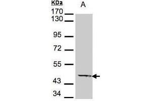 WB Image Sample A: 30μg of A431 whole cell lysate , 7. (Medium-Chain Specific Acyl-CoA Dehydrogenase, Mitochondrial (MCAD) (Center) 抗体)