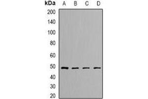 Western blot analysis of DLST expression in SKOV3 (A), Hela (B), mouse kidney (C), rat liver (D) whole cell lysates. (DLST 抗体)