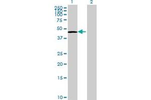 Western Blot analysis of SNIP1 expression in transfected 293T cell line by SNIP1 MaxPab polyclonal antibody. (SNIP1 抗体  (AA 1-396))