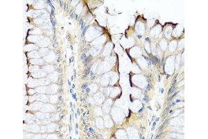 Immunohistochemistry of paraffin-embedded Human colon using INHBC Polyclonal Antibody at dilution of 1:100 (40x lens). (INHBC 抗体)