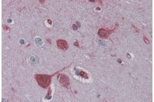 Immunohistochemistry (IHC) image for anti-RAE1 RNA Export 1 Homolog (S. Pombe) (RAE1) (C-Term) antibody (ABIN185434)
