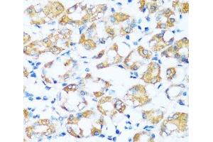 Immunohistochemistry of paraffin-embedded Human stomach using ARHGEF5 Polyclonal Antibody at dilution of 1:100 (40x lens). (ARHGEF5 抗体)
