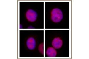 KLF5 antibody (pAb) tested by Immunofluorescence. (KLF5 抗体  (N-Term))