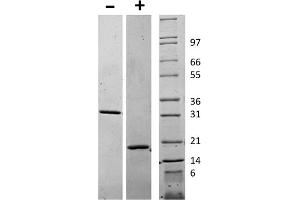 SDS-PAGE of Human Macrophage Colony Stimulating Factor Recombinant Protein SDS-PAGE of Human Macrophage Colony Stimulating Factor Recombinant Protein. (M-CSF/CSF1 蛋白)