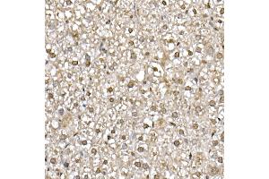 Immunohistochemistry of paraffin-embedded mouse liver using UB Rabbit mAb (ABIN7271128) at dilution of 1:50 (40x lens).