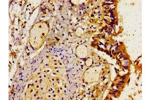 Immunohistochemistry of paraffin-embedded human lung tissue using ABIN7158808 at dilution of 1:100 (LAMP3 抗体  (AA 28-224))