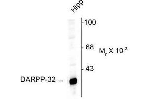 Image no. 1 for anti-Protein Phosphatase 1, Regulatory (Inhibitor) Subunit 1B (PPP1R1B) (N-Term) antibody (ABIN372605) (DARPP32 抗体  (N-Term))