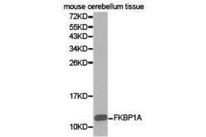 Western Blotting (WB) image for anti-FK506 Binding Protein 1A, 12kDa (FKBP1A) antibody (ABIN1872697) (FKBP1A 抗体)