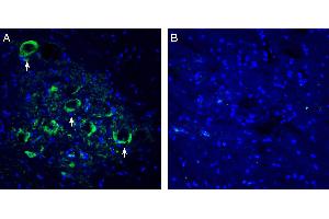 Expression of Connexin-47 in rat spinal cord ventral horn region. (Gap Junction Protein, gamma 2, 47kDa (GJC2) Peptide)